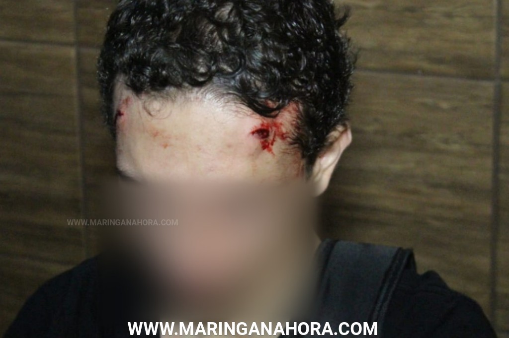 foto de Estudante é agredido com coronhadas na cabeça durante roubo em Maringá