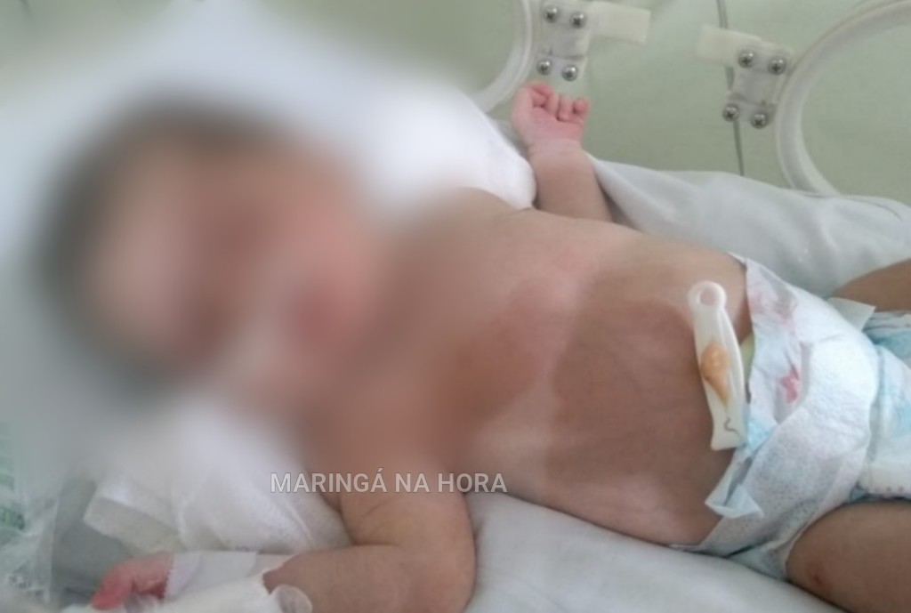 foto de Família faz apelo para salvar bebê que nasceu com tumor no estômago em Sarandi