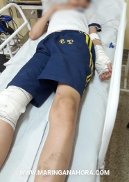 foto de Paiçandu - Motociclista atropela adolescente e foge sem prestar socorro 