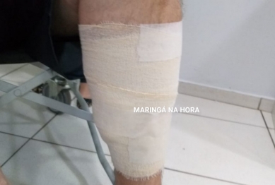 foto de Empresário Maringaense agredido por um motorista de ônibus recebe alta médica – “nasci de novo”