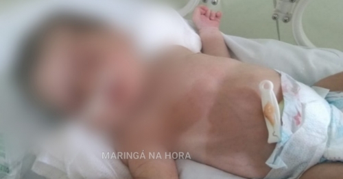 Família faz apelo para salvar bebê que nasceu com tumor no estômago em Sarandi