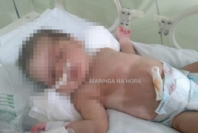 foto de Família faz apelo para salvar bebê que nasceu com tumor no estômago em Sarandi