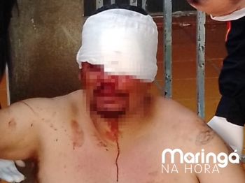 foto de Homem fica gravemente ferido após ser brutalmente agredido em Maringá